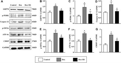 Resolvin D1 Attenuates Doxorubicin-Induced Cardiotoxicity by Inhibiting Inflammation, Oxidative and Endoplasmic Reticulum Stress